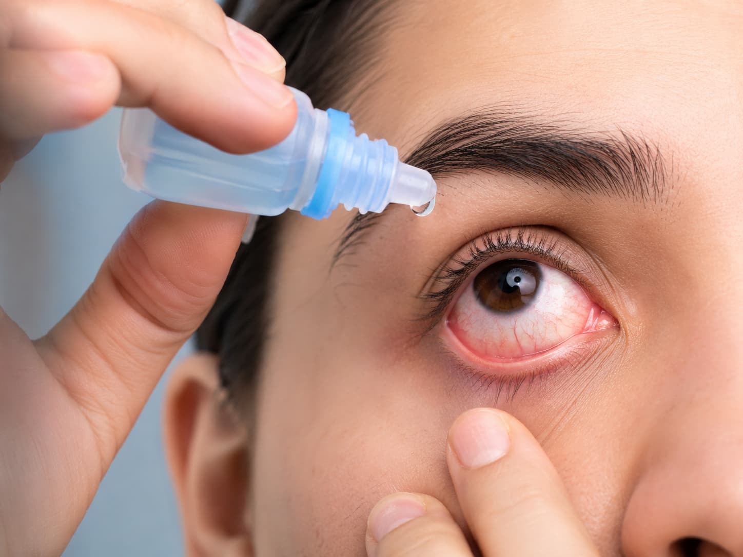 conjunctivitis treatment